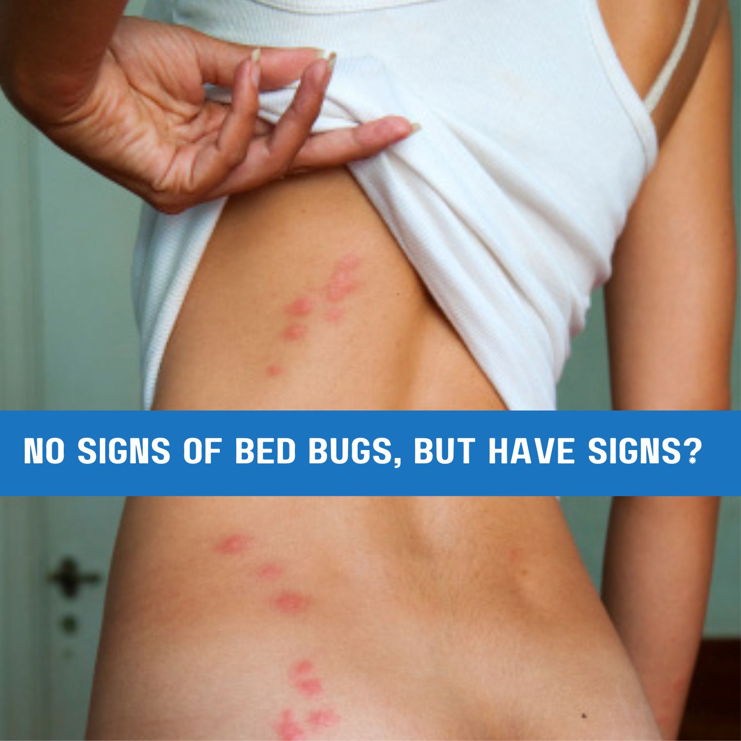 No signs of bed bugs but I have bites